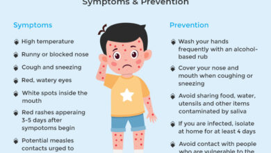 Measles Symptoms