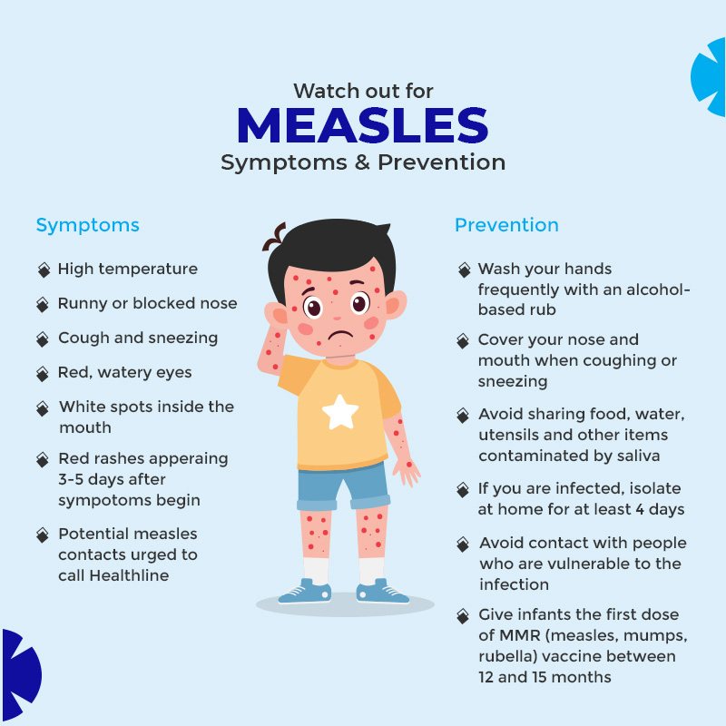 Measles-Symtopms-and-Prevention